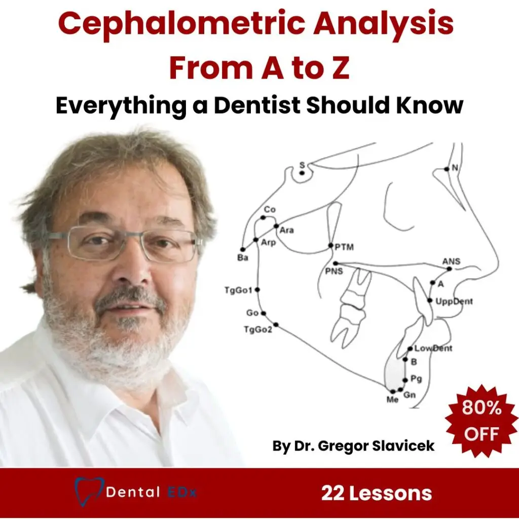 Cephalometric Analysis from A to Z