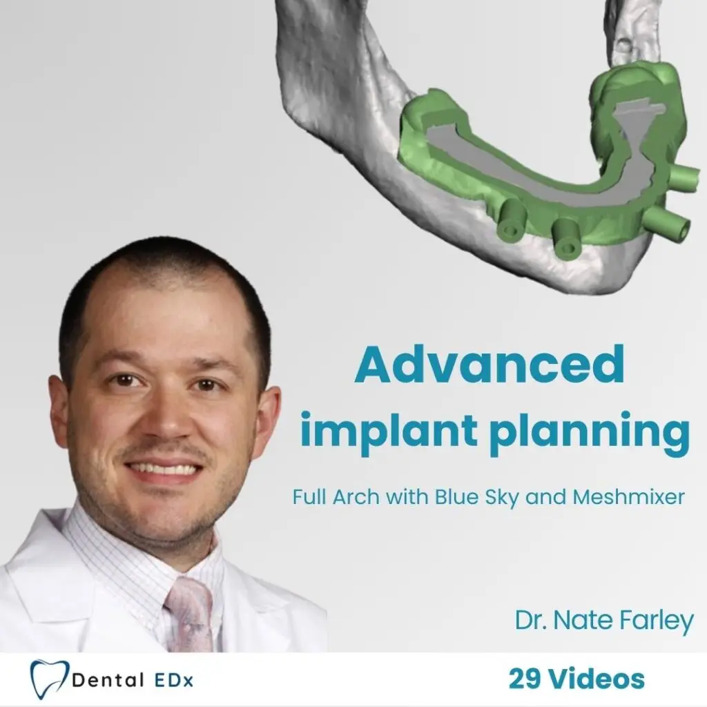 Advanced Implant Planning