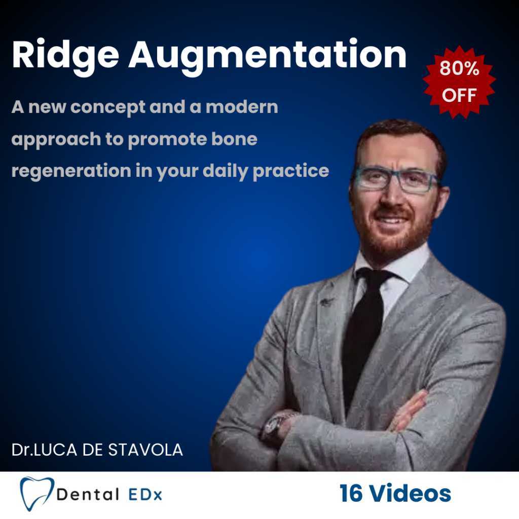 Ridge Augmentation