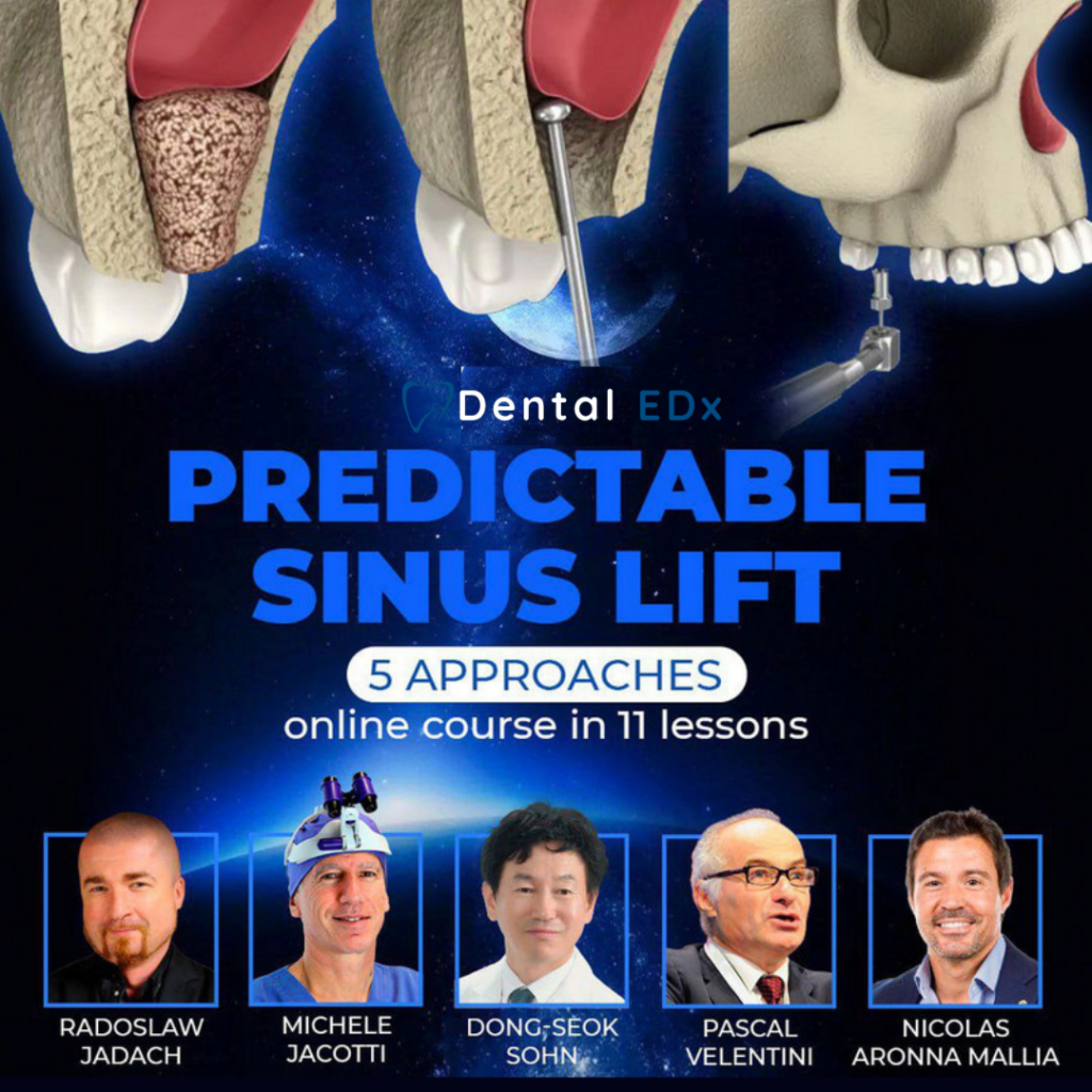 Predictable Sinus Lift